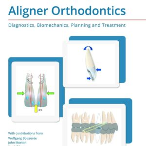 Aligner Orthodontics: Diagnostics, Biomechanics, Planning and Treatment 1st Edition (Scanned copy)