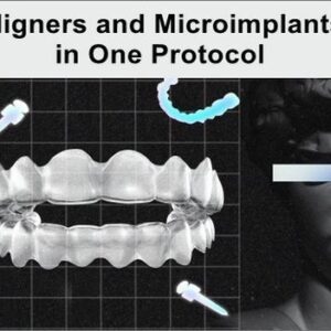 Aligners and Microimplants in One Protocol