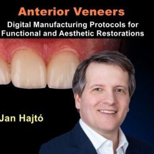 Anterior Veneers: Digital Manufacturing Protocols for Functional and Aesthetic Restorations