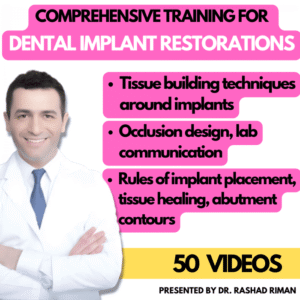 Implant Restorations Simplified: Restore Dental Implants with Accuracy & Confidence (Surgical Master)