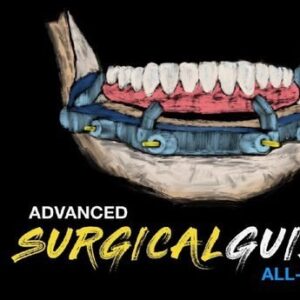 Implant Ninja, Advanced Surgical Guides – All on X