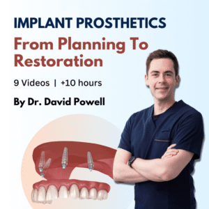 Implant Prosthetics: from Planning to Restoration
