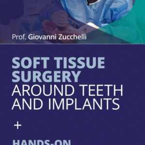 Soft tissue surgery around teeth and implants