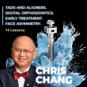 TADs and aligners, Digital orthodontics, Early treatment, Face asymmetry