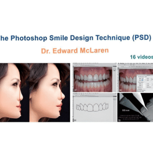 The Photoshop Smile Design Technique (PSD)