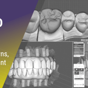 BASIC EXOCAD | Models, Crowns, Splints, Implant Crowns, AOX, & More