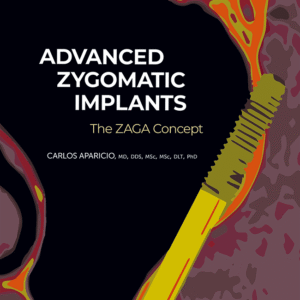 Advanced Zygomatic Implants: The ZAGA Concept