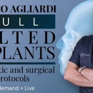 The Tilted Implant Approach: Biomechanics, Surgery and Prosthetic Solutions