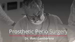 Occlusion Meets Periodontics: Surgical Techniques for Prosthetically Driven Cases