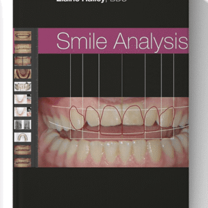 Smile Analysis 1st Edition