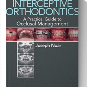 Interceptive Orthodontics: A Practical Guide to Occlusal Management 1st Edition