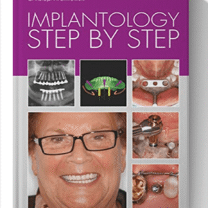 Implantology Step by Step 1st Edition