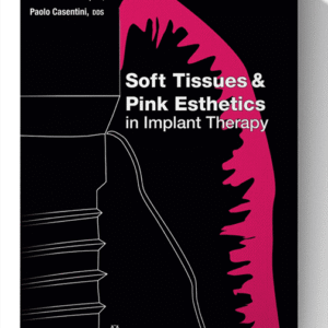 Soft Tissues and Pink Esthetics in Implant Therapy 1st Edition