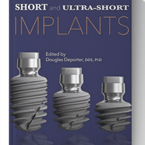 Short and Ultra-Short Implants 1st Edition
