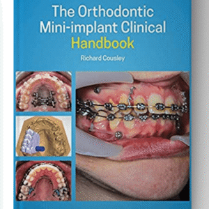 The Orthodontic Mini implant Clinical Handbook 2nd Edition