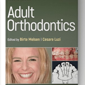 Adult Orthodontics 2nd Edition