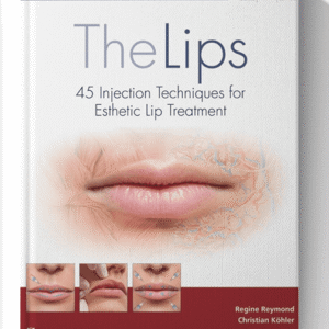 The Lips: 45 Injection Techniques for Esthetic Lip Treatment 1st Edition (Scanned)