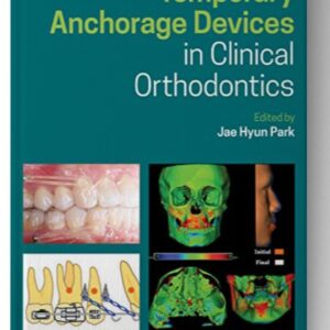 Temporary Anchorage Devices in Clinical Orthodontics 1st Edition