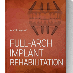 Full-Arch Implant Rehabilitation 1st Edition