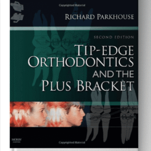 Tip Edge Orthodontics and the Plus Bracket 2nd Edition