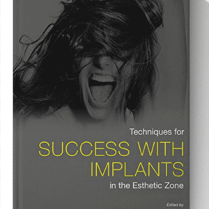 Techniques for Success With Implants in the Esthetic Zone 1st Edition