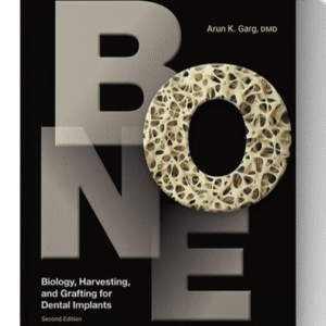 Bone: Biology, Harvesting, and Grafting for Dental Implants 2nd Edition