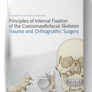 Principles of Internal Fixation of the Craniomaxillofacial Skeleton: Trauma and Orthognathic Surgery 1st Edition