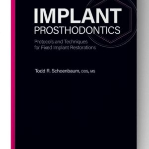 Implant Prosthodontics: Protocols and Techniques for Fixed Implant Restorations (Scanned)