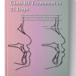 New Concept for Class III Treatment in 21 Days