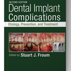 Dental Implant Complications: Etiology, Prevention, and Treatment 2nd Edition