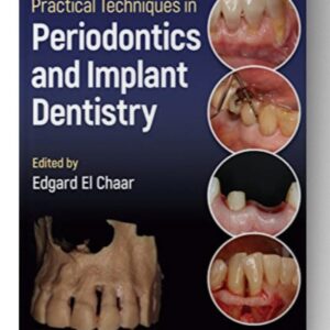 Practical Techniques in Periodontics and Implant Dentistry 1st Edition