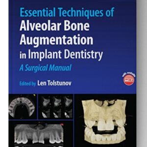 Essential Techniques of Alveolar Bone Augmentation in Implant Dentistry: A Surgical Manual 2nd Edition