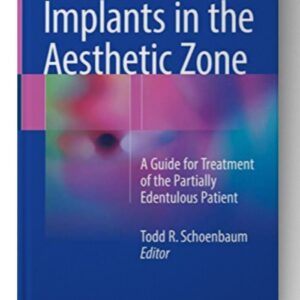 Implants in the Aesthetic Zone: A Guide for Treatment of the Partially Edentulous Patient 1st ed.