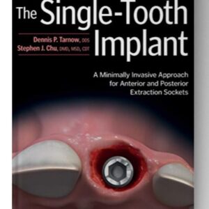 The Single-Tooth Implant: A Minimally Invasive Approach for Anterior and Posterior Extraction Sockets 1st Edition