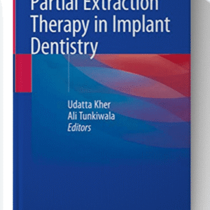 Partial Extraction Therapy in Implant Dentistry 1st ed