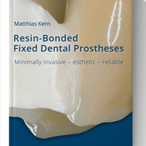Resin-Bonded Fixed Dental Prostheses: Minimally invasive – esthetic – reliable 1st Edition