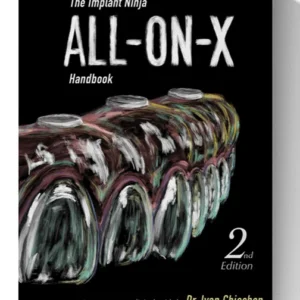 Ninja All-on-X Implant Manual: A Step-by-Step Clinical Guide, 2nd Edition